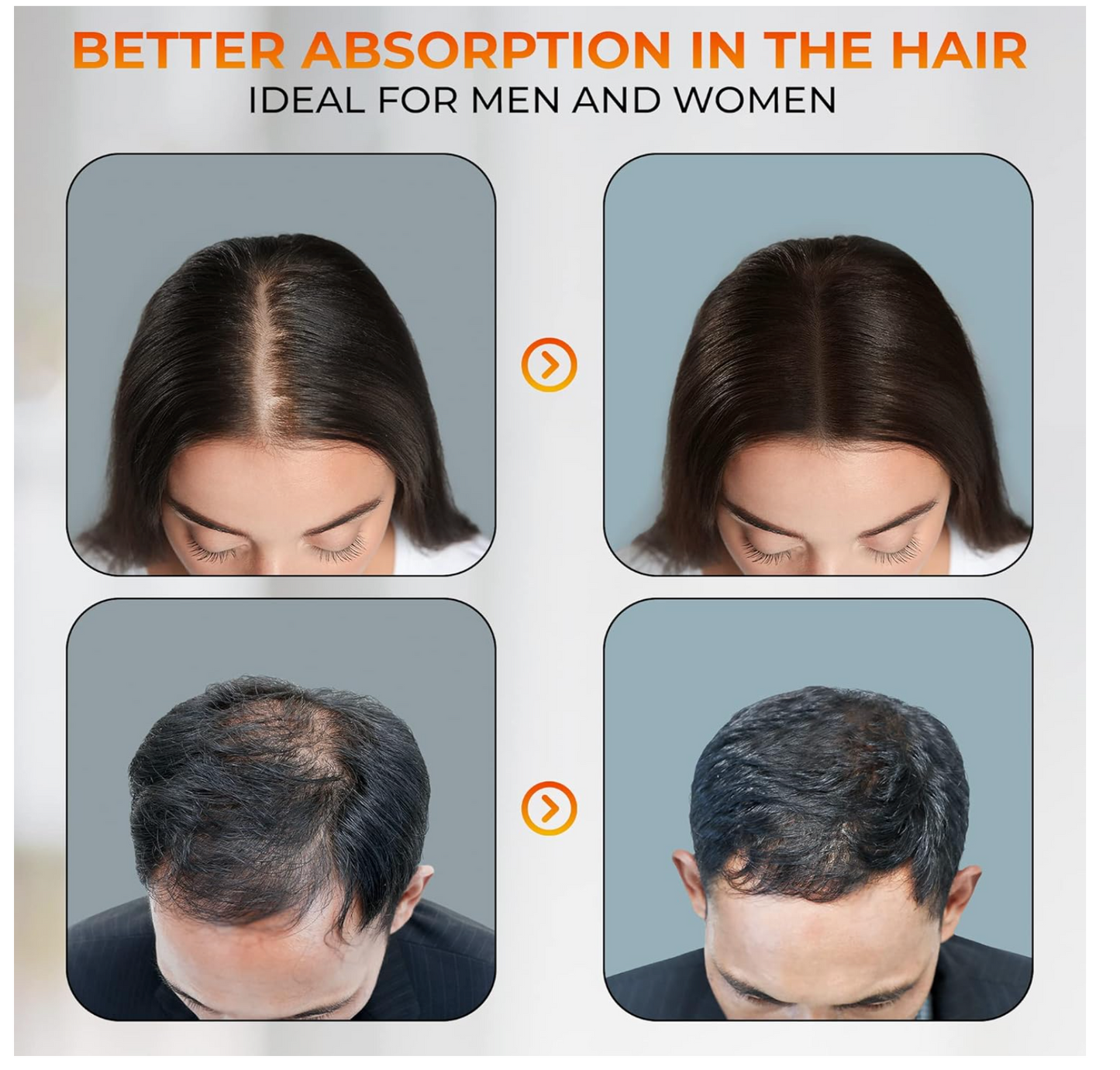 Vitaminas cabello. Reparador cabello. Para trasplante capilar. Alta dosis de Zinc y Vitamina B. HAIR ENERGY, complejo vitamínico generador energía capilar. 60 cápsulas.