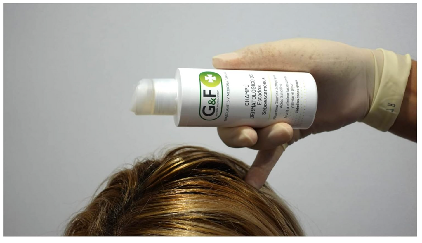 Champú para Dermatitis Seborreica y Estados Descamativos - Reduce Picor, Exceso de Sebo y Facilita Eliminación de Escamas - Para Pelo Graso - 125ml