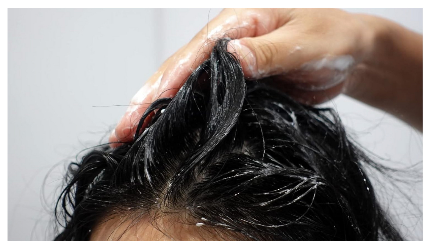 Champú para Dermatitis Seborreica y Estados Descamativos - Reduce Picor, Exceso de Sebo y Facilita Eliminación de Escamas - Para Pelo Graso - 125ml