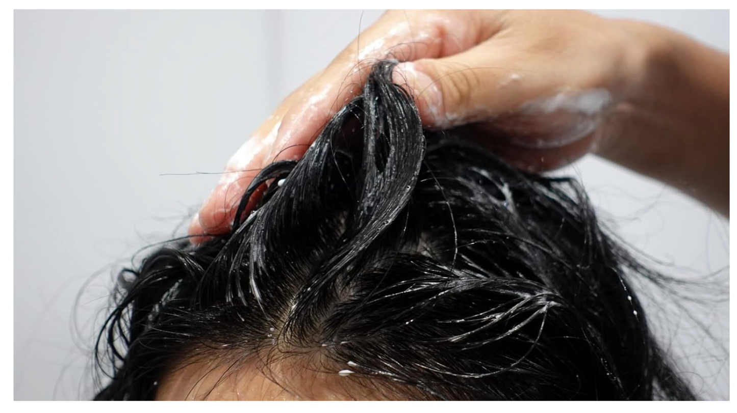 Champú anticaspa. Champú pelo graso. Champú purificante anticaspa en botella de 300ml. Shampoo anticaspa que controla el exceso de producción de grasa. Champú anti caspa y grasa.