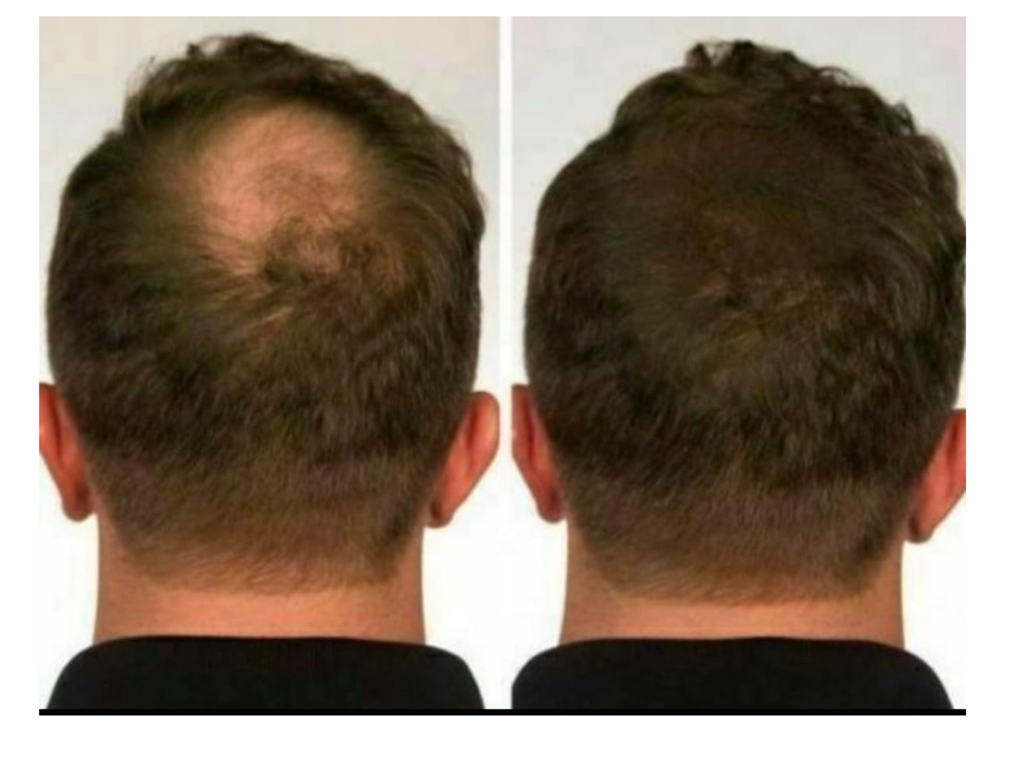 Fibras capilares con Queratina, Biotina y Henna. Keratin Fibers. Fibras capilares con aplicador 6 tonalidades de rubio, castaño, gris y negro. Fibras capilares aplicador 12 gramos. LIGHT BLONDE